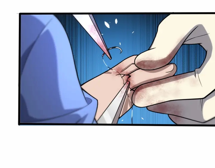 第58话 断指再植86