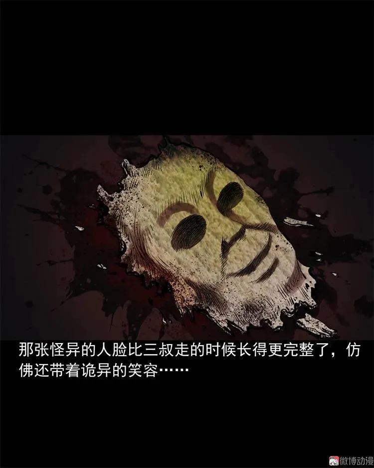 李中平的怪病70