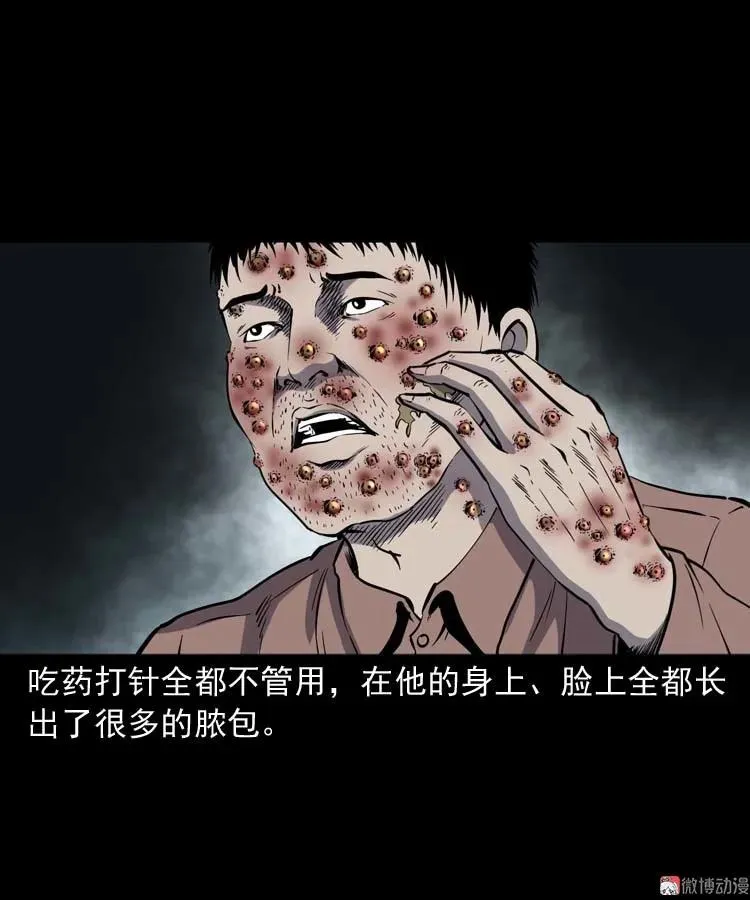 误诊65