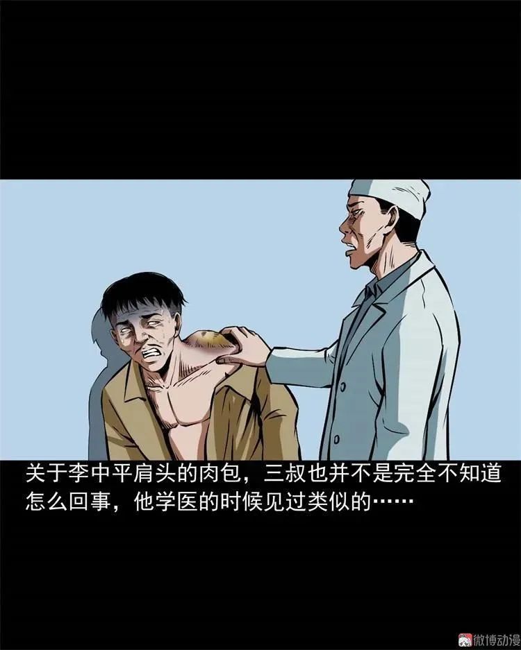 李中平的怪病23