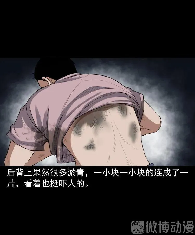 自杀37