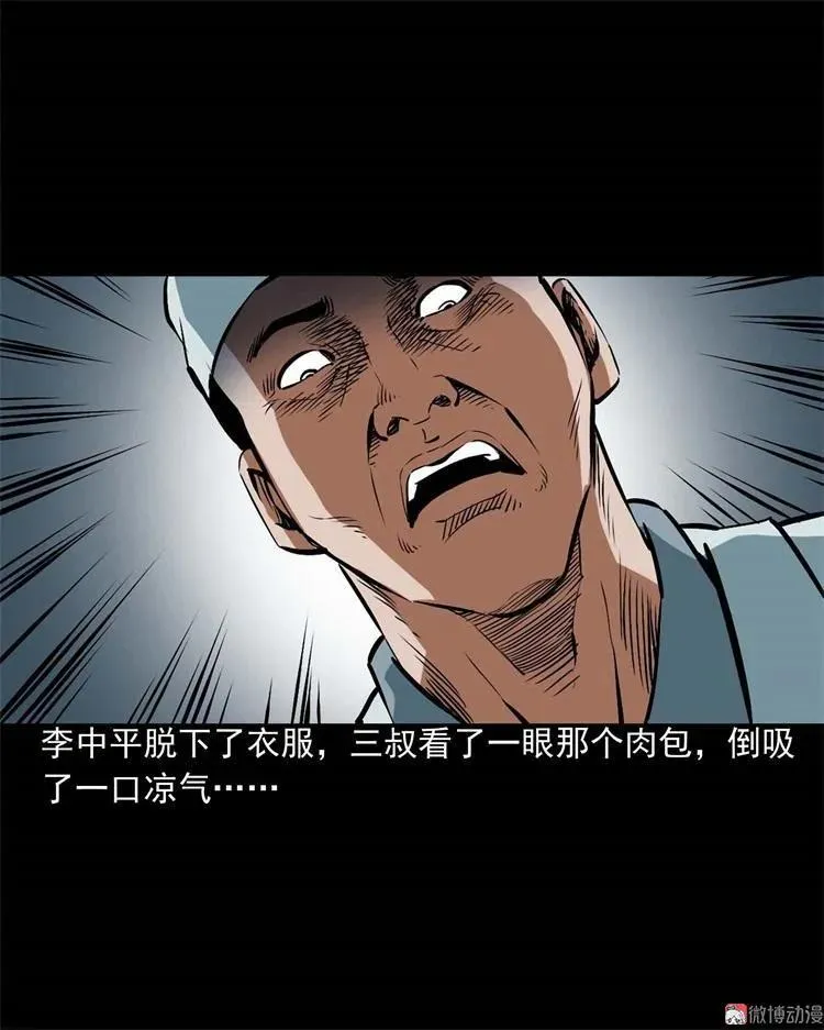 李中平的怪病16