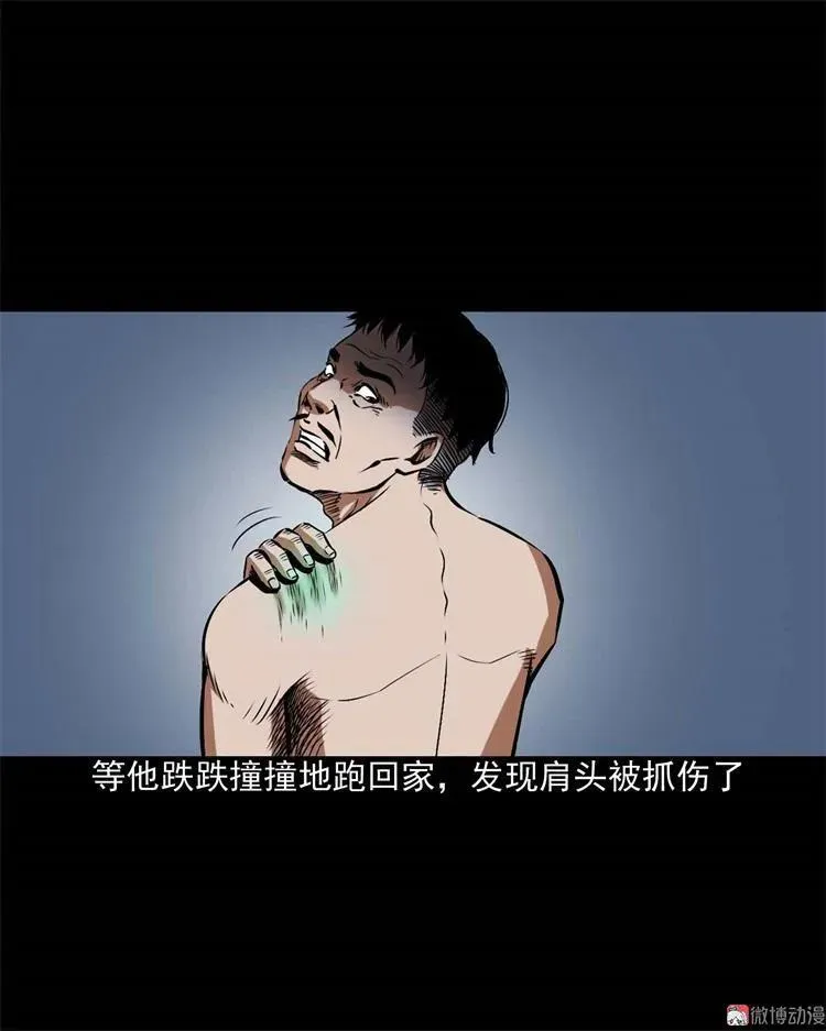 李中平的怪病55