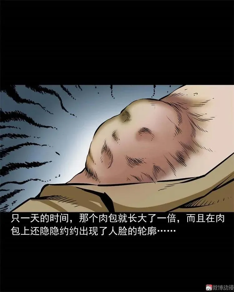 李中平的怪病17
