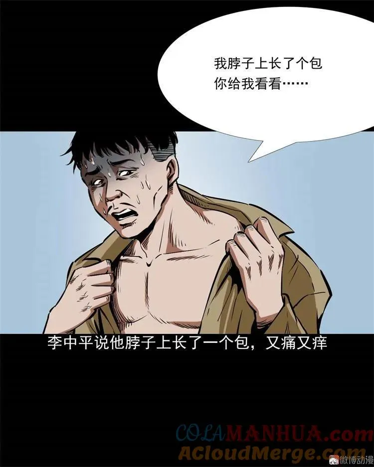 李中平的怪病3