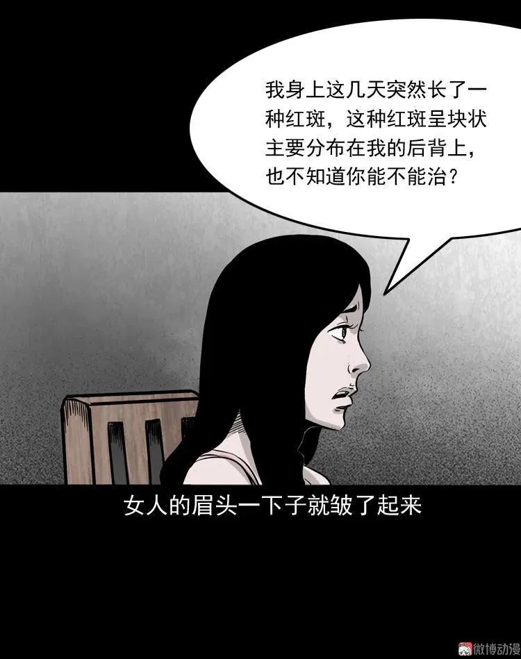 尸斑32