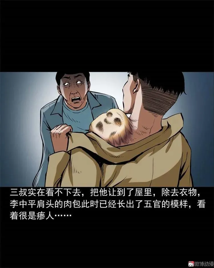 李中平的怪病35