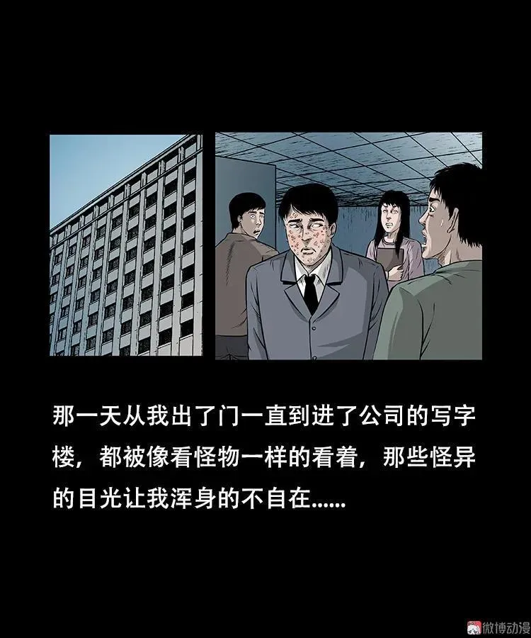 怪病20