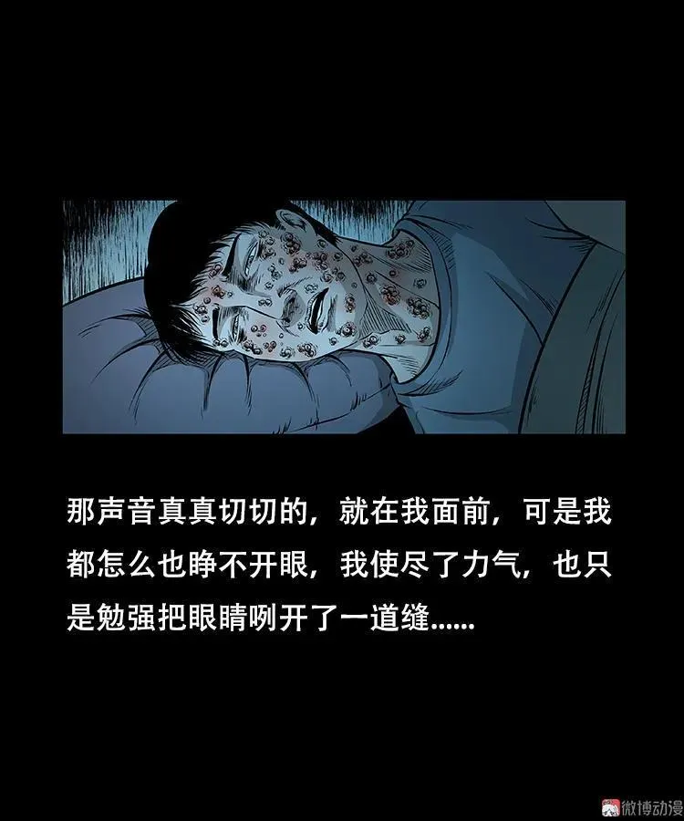 怪病31