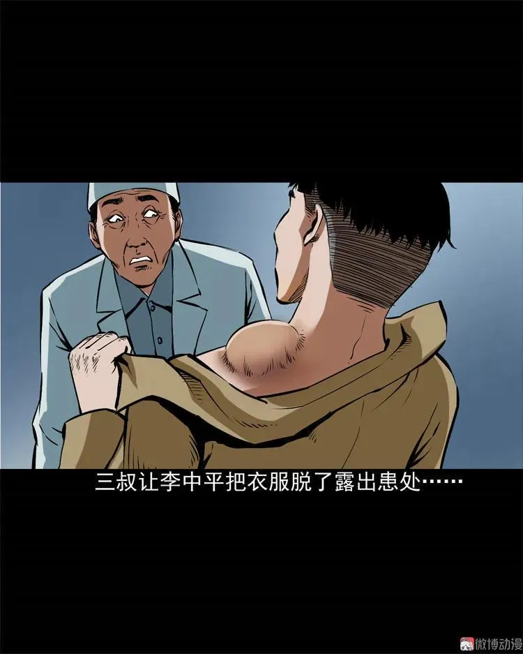 李中平的怪病4