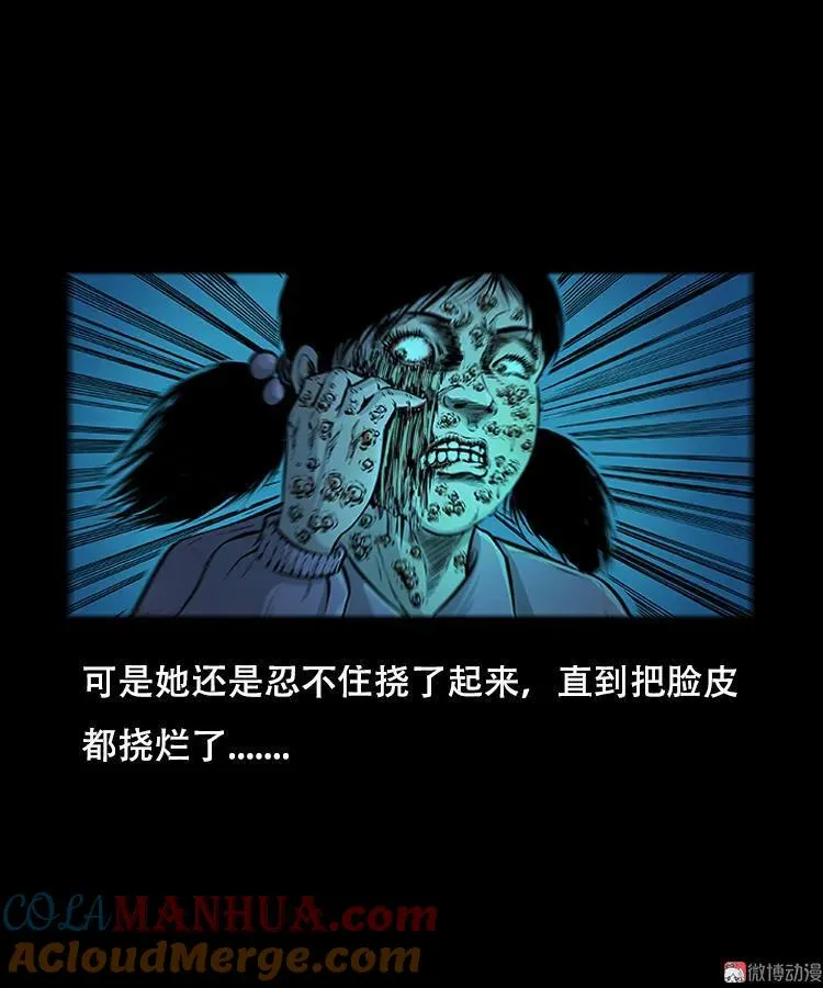 怪病33
