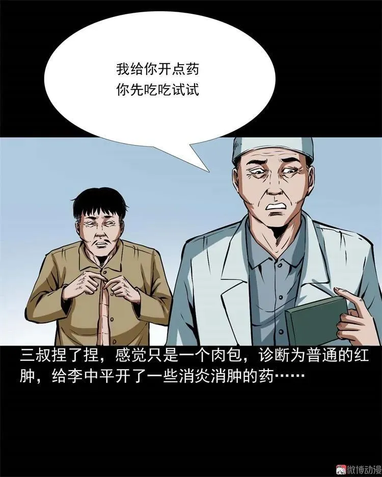 李中平的怪病7