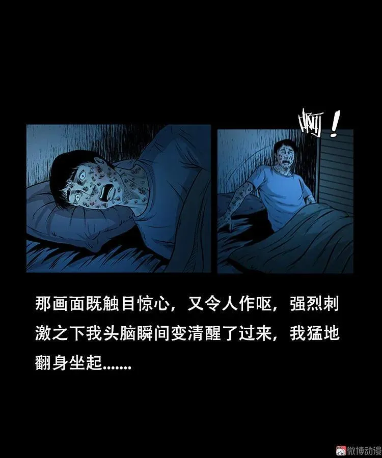 怪病34