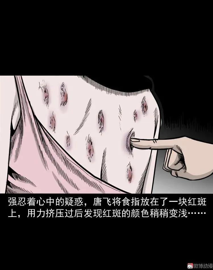 尸斑41