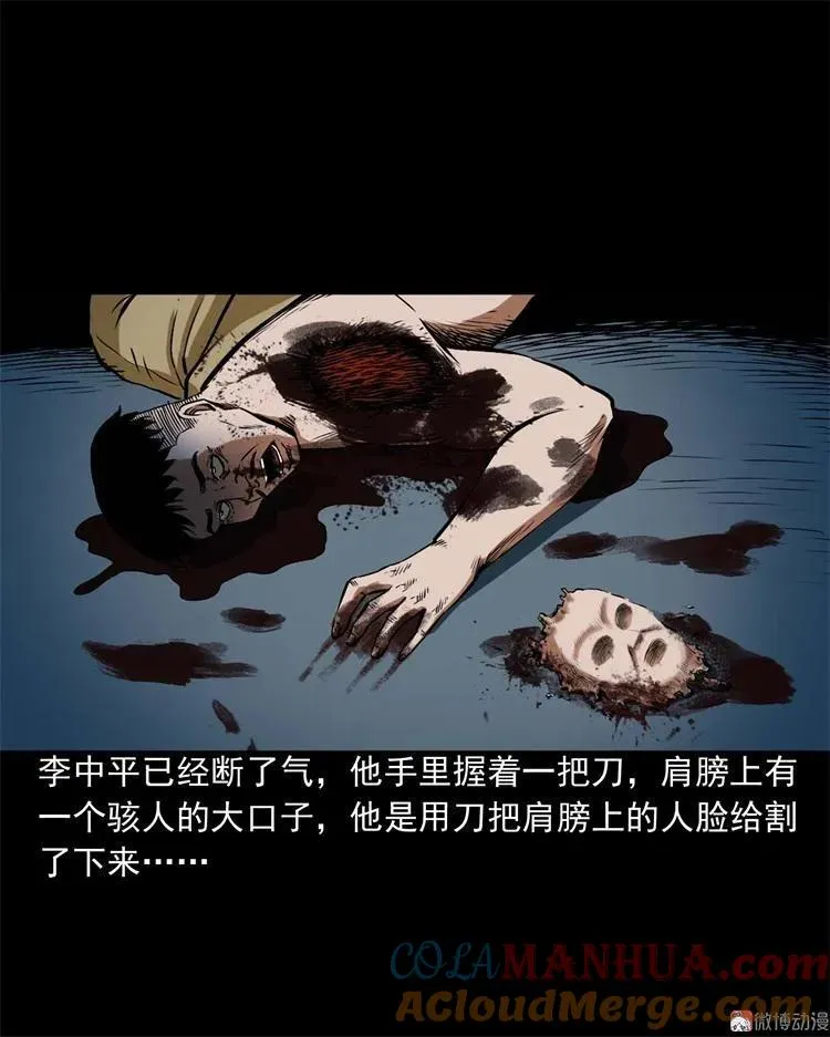 李中平的怪病69
