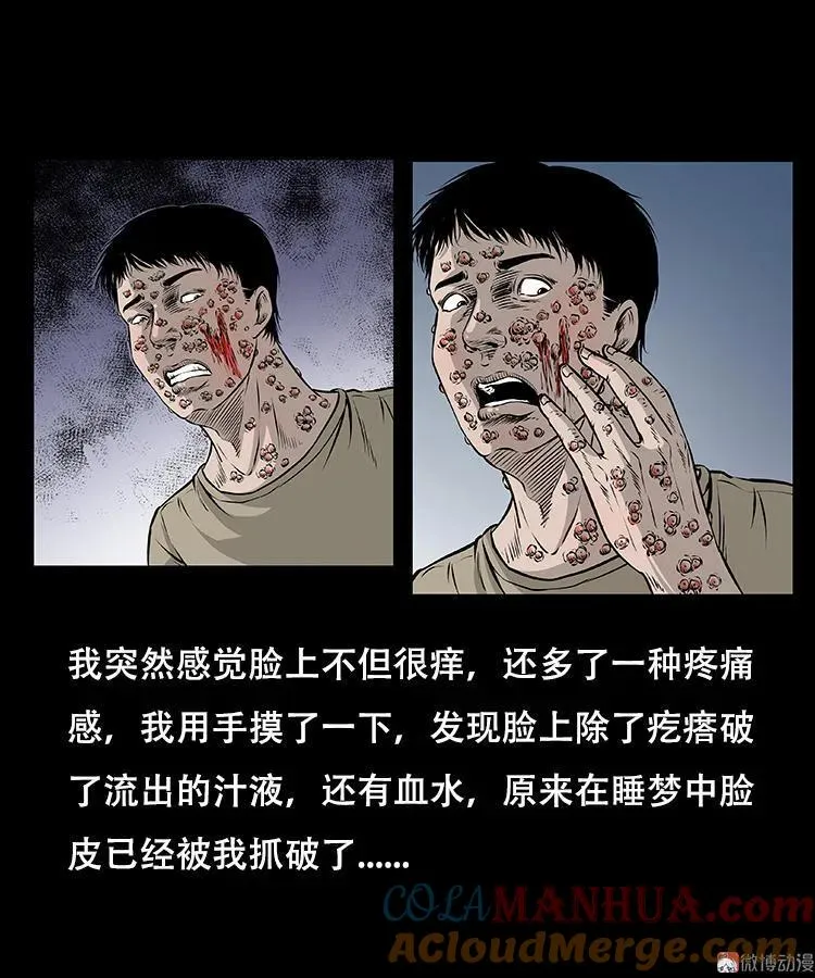 怪病36