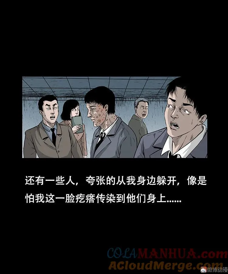 怪病21