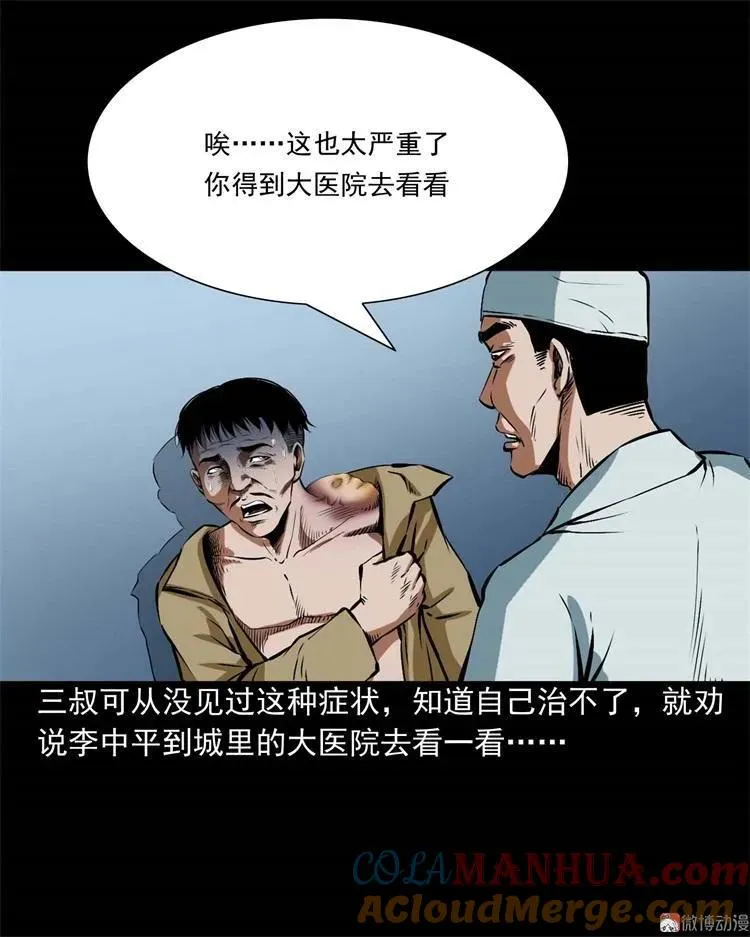 李中平的怪病18