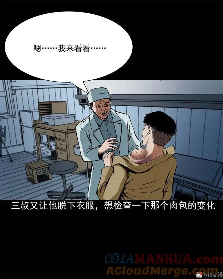 李中平的怪病15