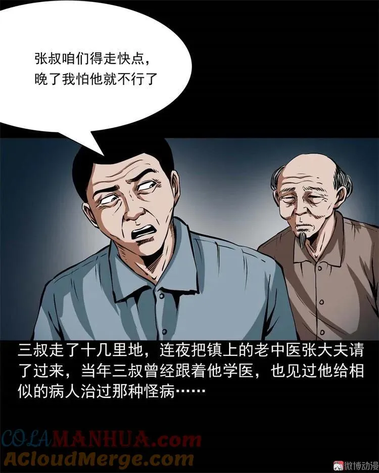 李中平的怪病63