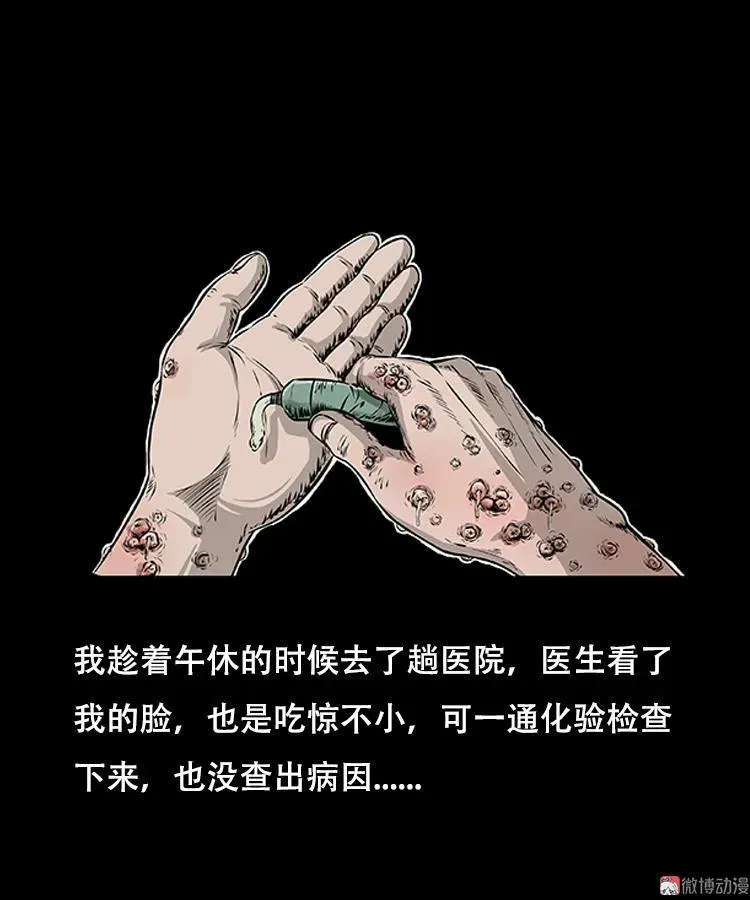 怪病26