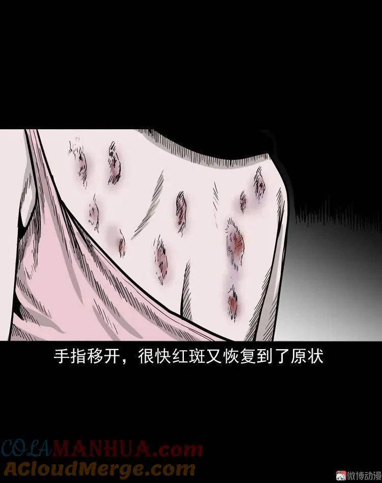 尸斑42