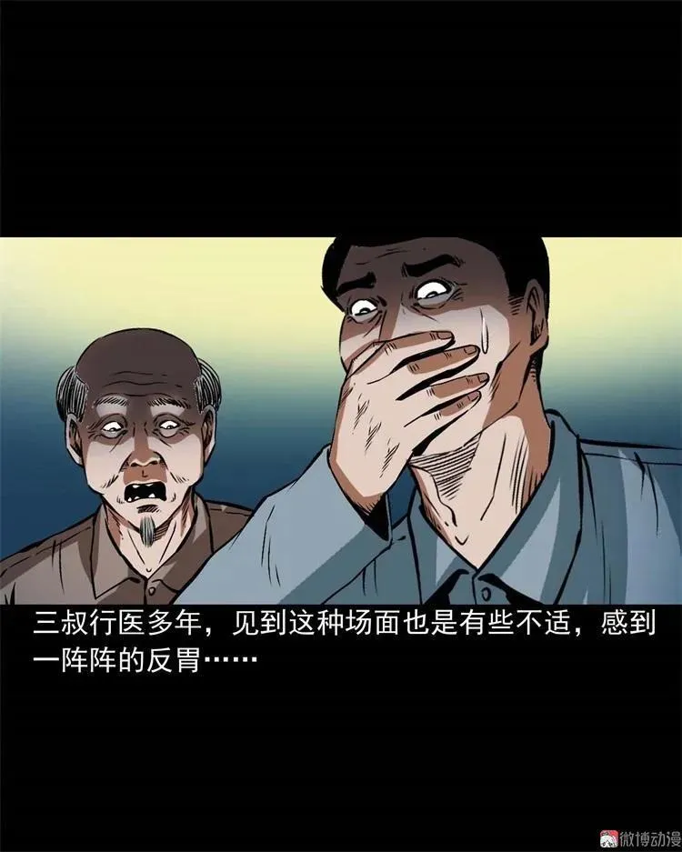 李中平的怪病71