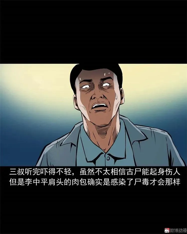 李中平的怪病58