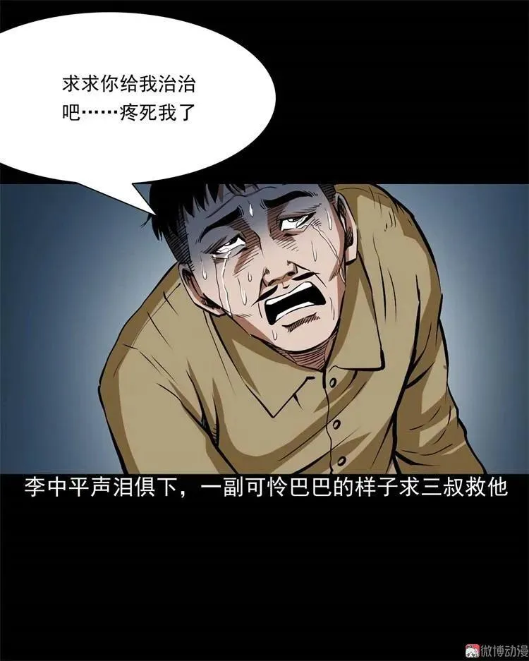 李中平的怪病34