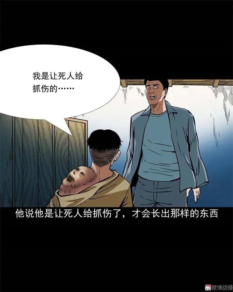 李中平的怪病38