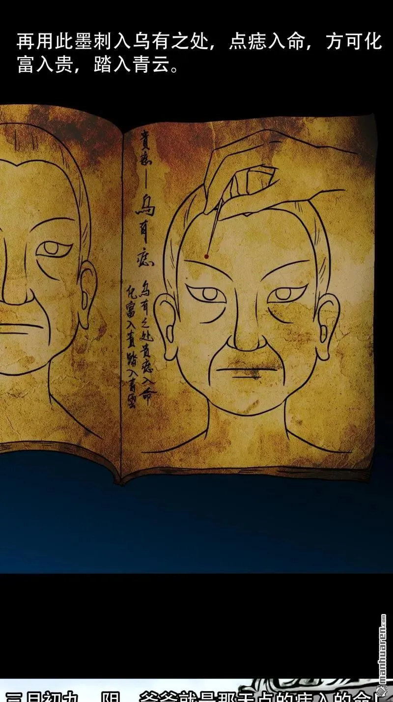 第277回 错点痣16