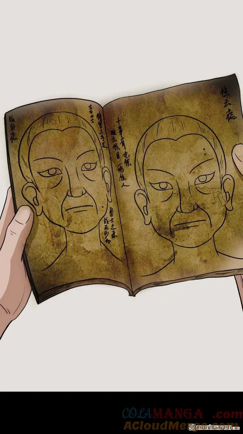第278回 鸡橛痣39