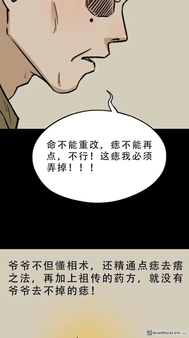 第277回 错点痣32