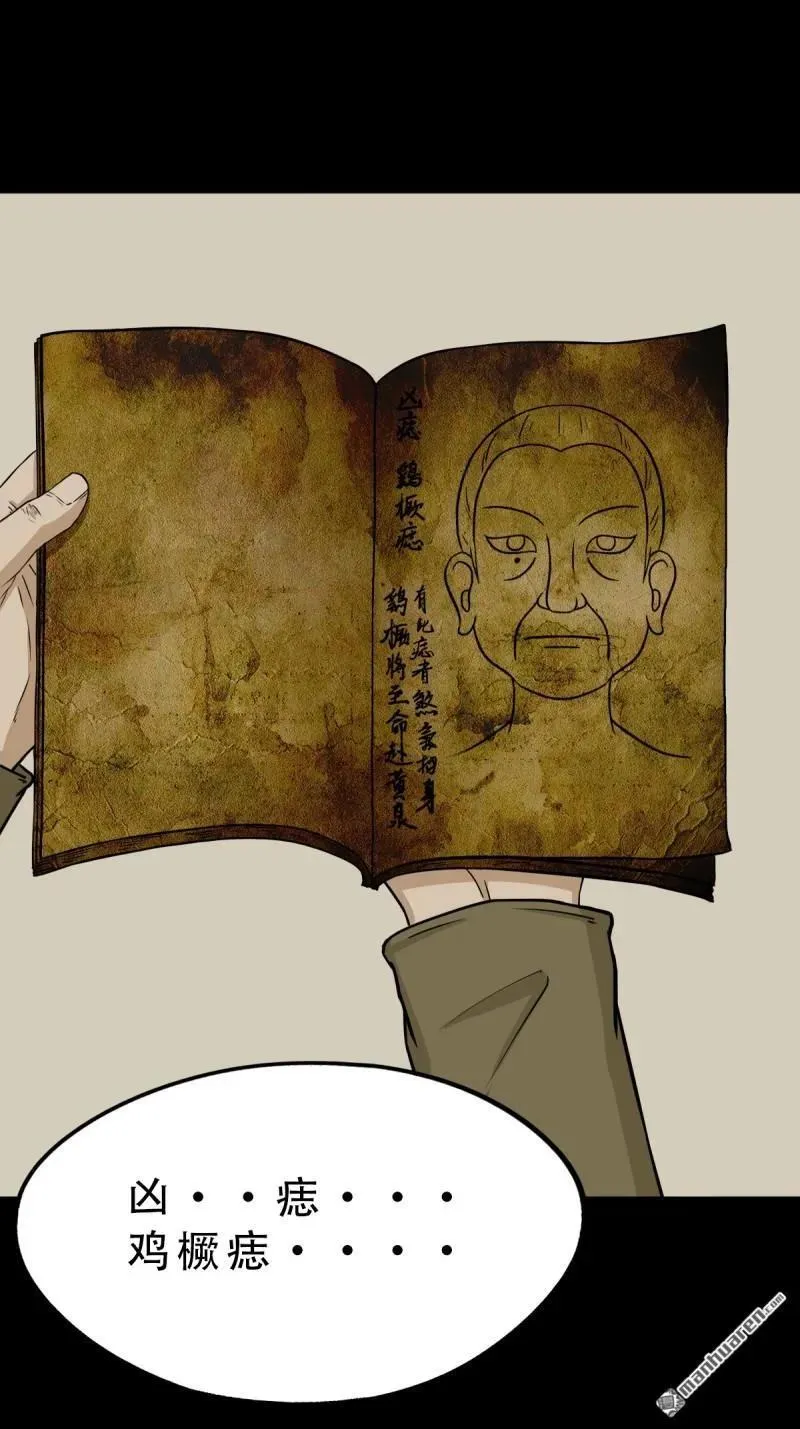 第277回 错点痣28