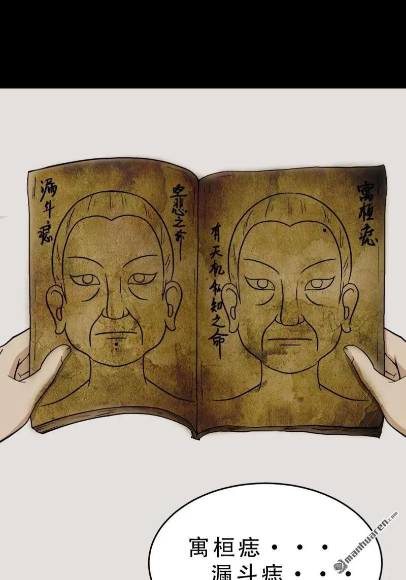 第278回 鸡橛痣40