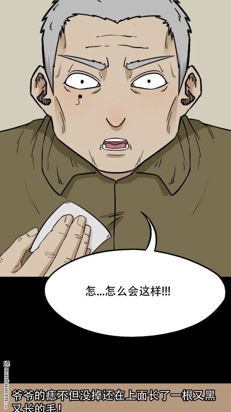第277回 错点痣40
