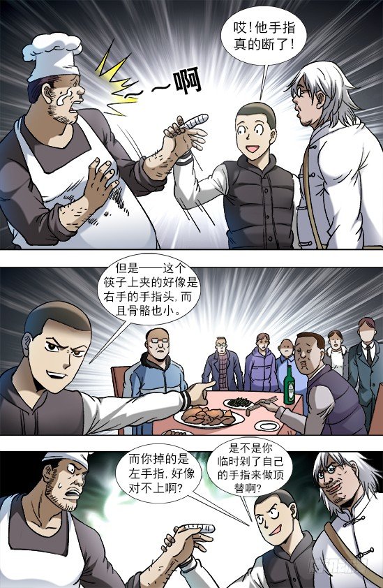 851 断手指8