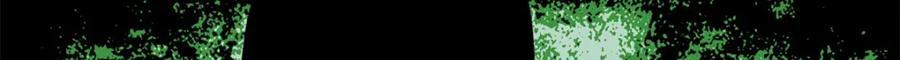 269 接掌手术19