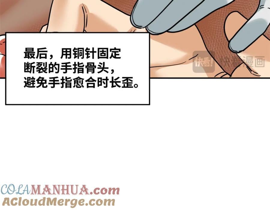 269 接掌手术36