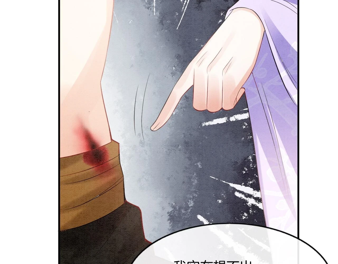 第64话 本宫给皇上上药25