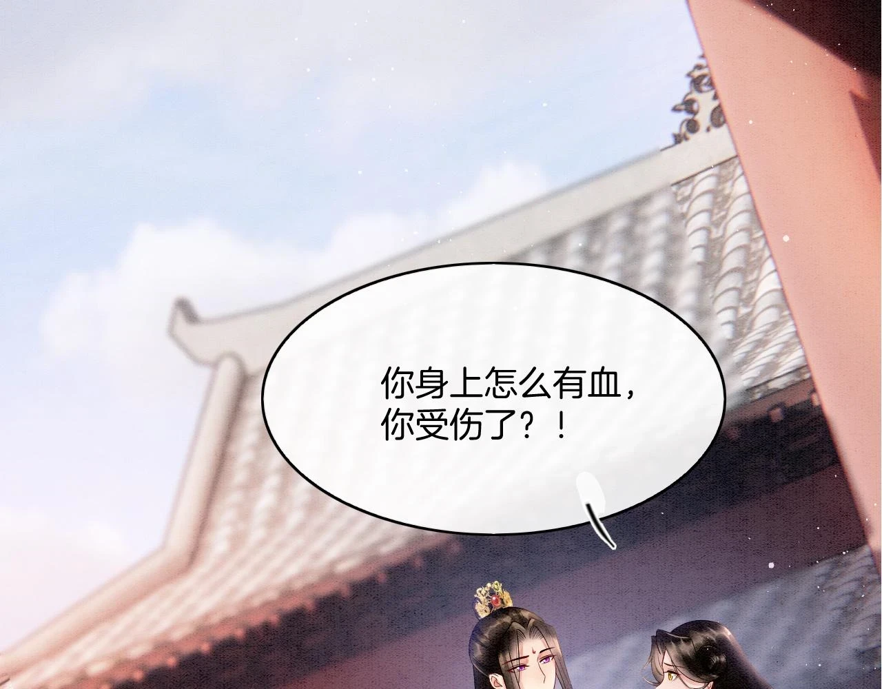 第64话 本宫给皇上上药5