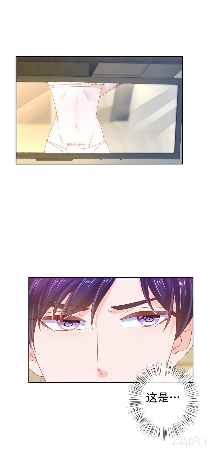 第139话 肚子上的疤痕24