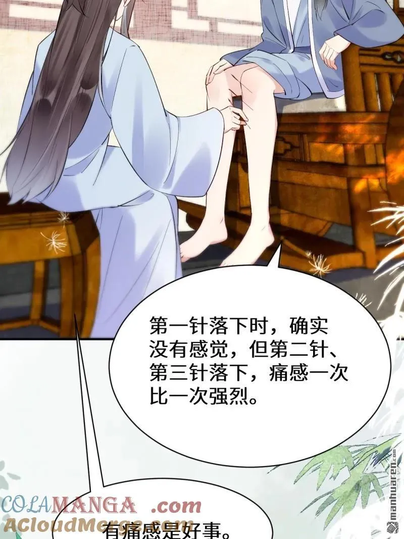 第613回 银针刺穴48