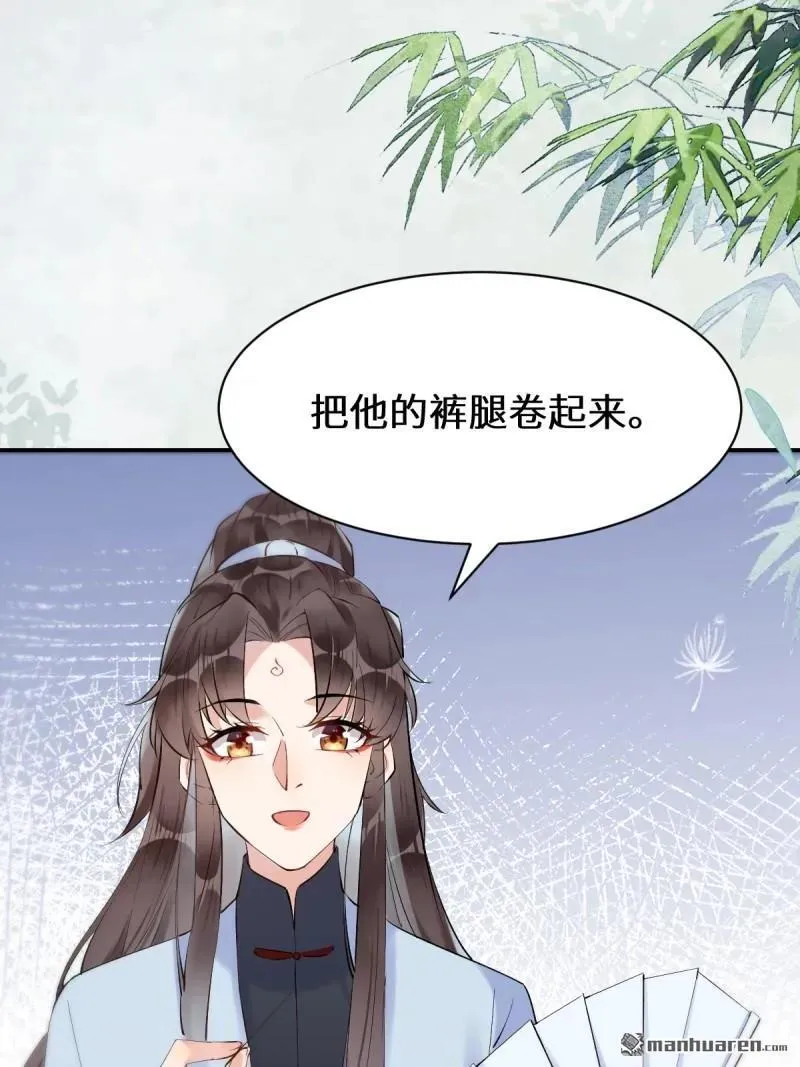 第613回 银针刺穴35