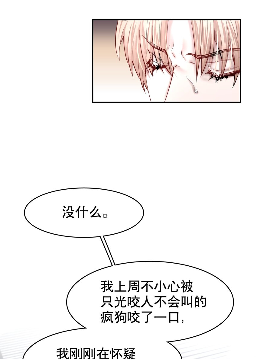 第33章 疯狗咬了一口28