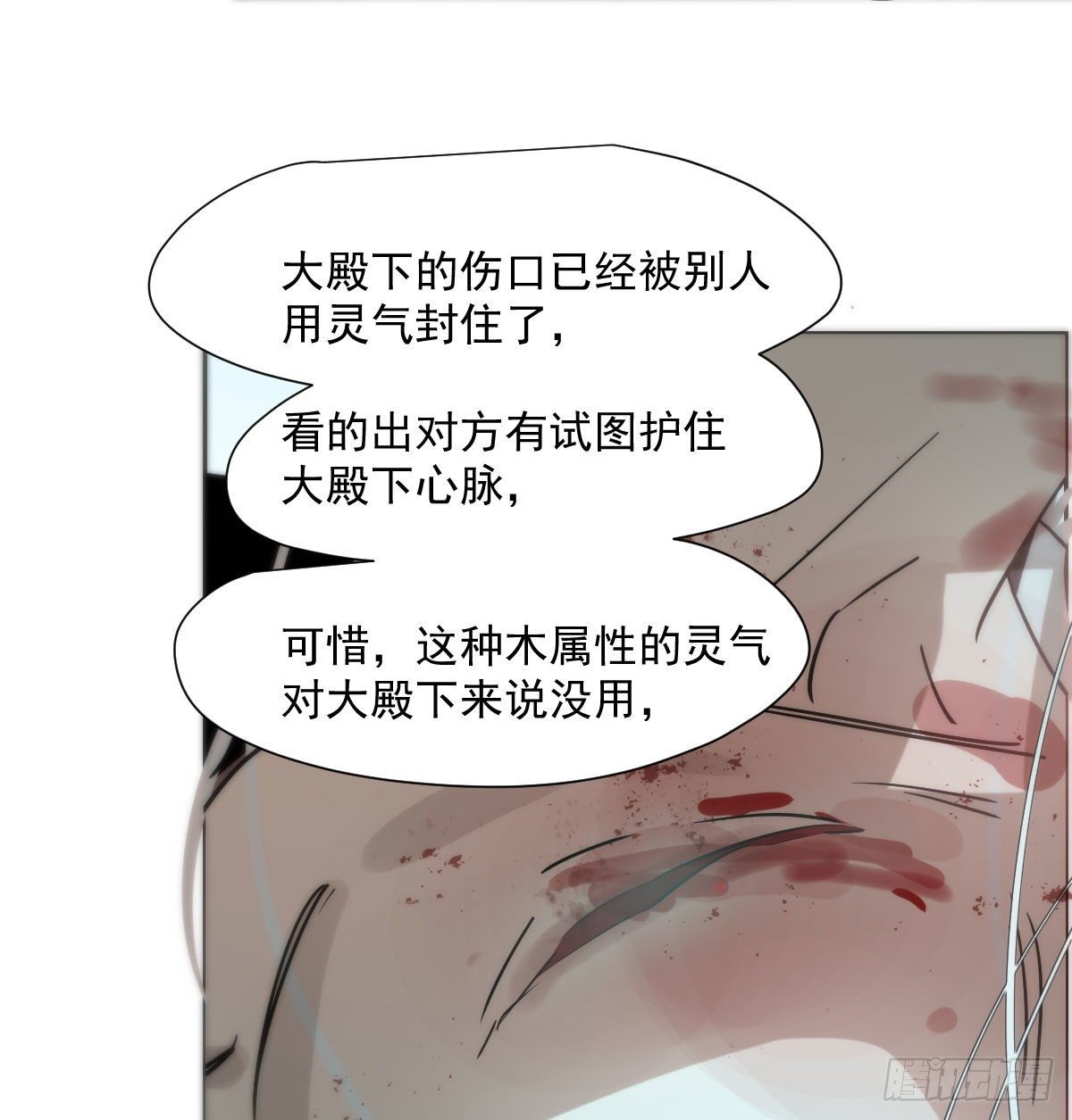 第184话 回天乏术62