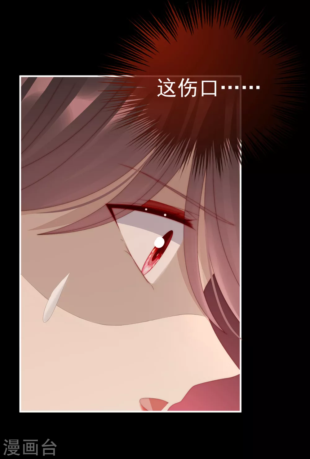 第63话 小猪仔要死了？！22