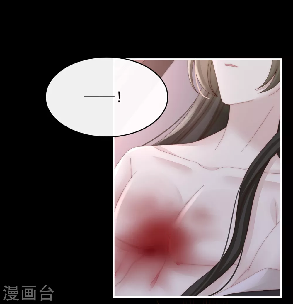第63话 小猪仔要死了？！21
