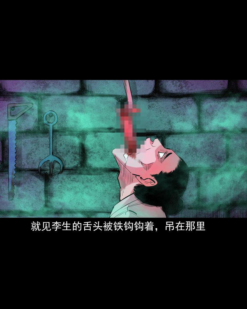 74 第74话拔舌之症35