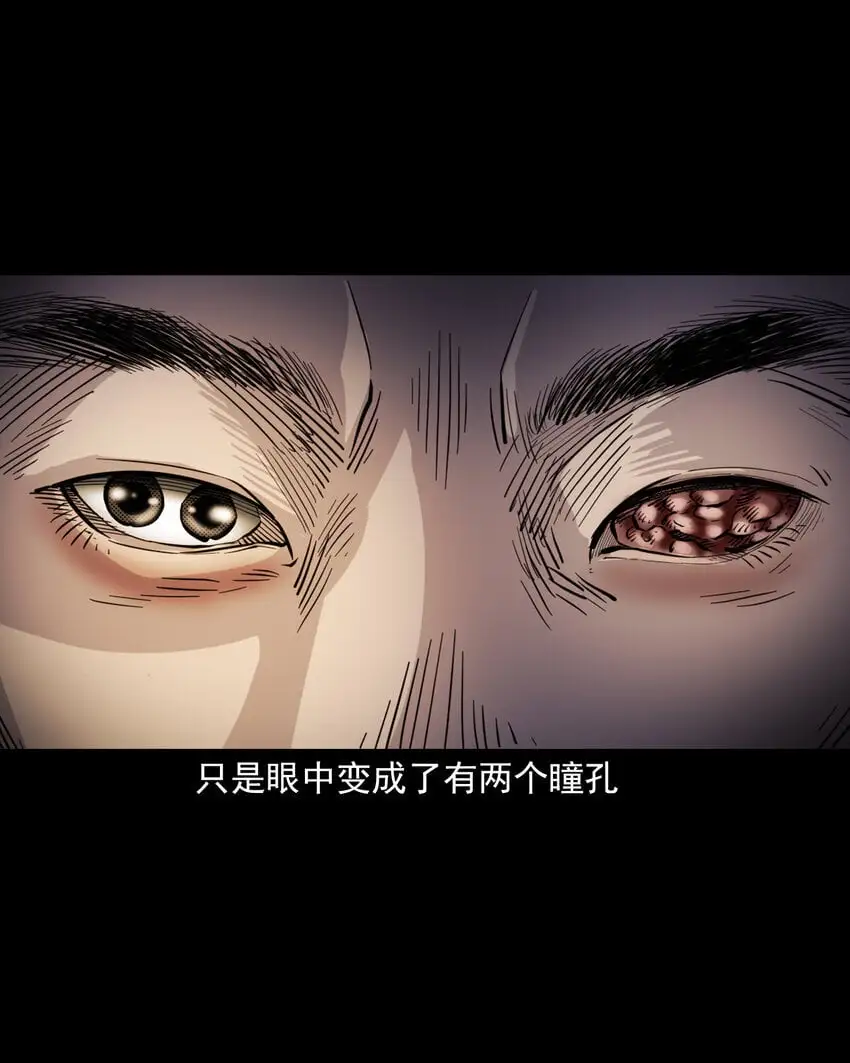 113 第113话双瞳29